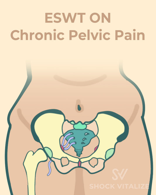 SHOCKVITALIZE Your Pelvic Pain: Crush Chronic Pelvic Pain with ESWT Power