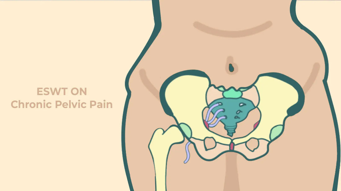 SHOCKVITALIZE Your Pelvic Pain: Crush Chronic Pelvic Pain with ESWT Power SHOCK VITALIZE