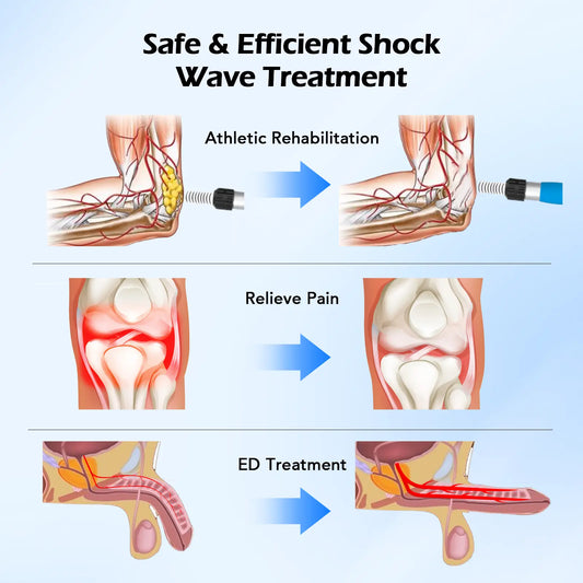 Healing Beyond the Surface: The Power of Extracorporeal Shock-Wave Therapy SHOCK VITALIZE